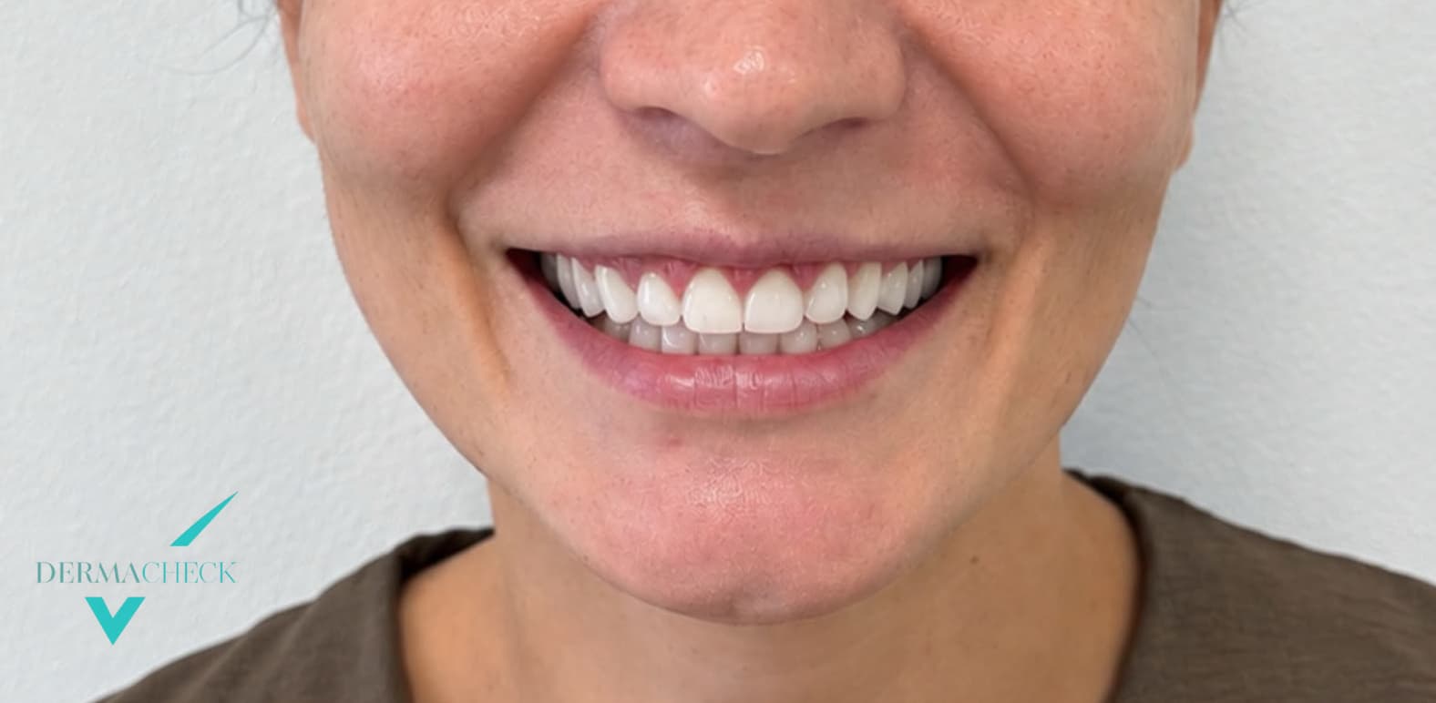 Patient after treatment