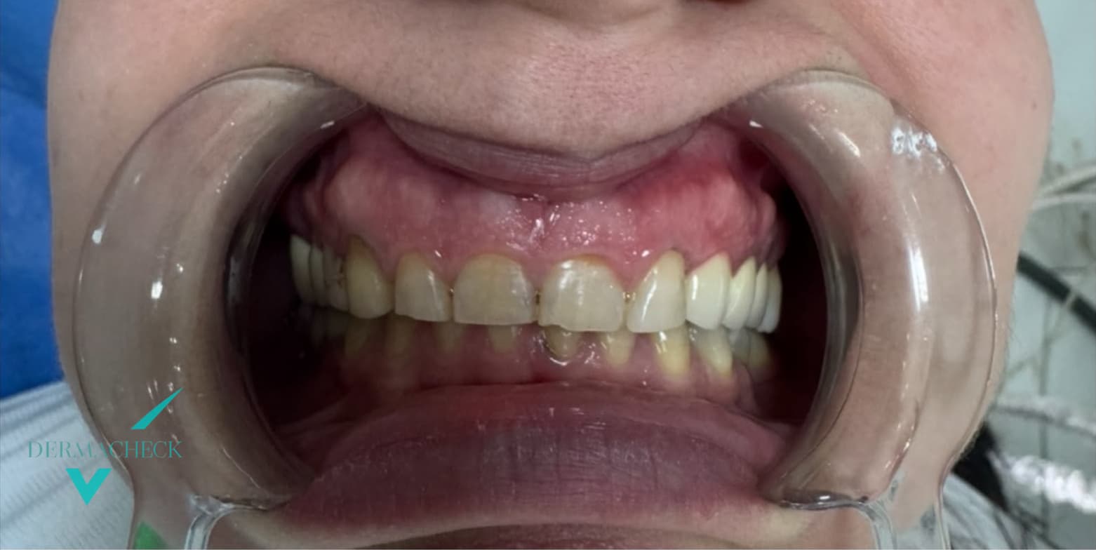 Patient before treatment