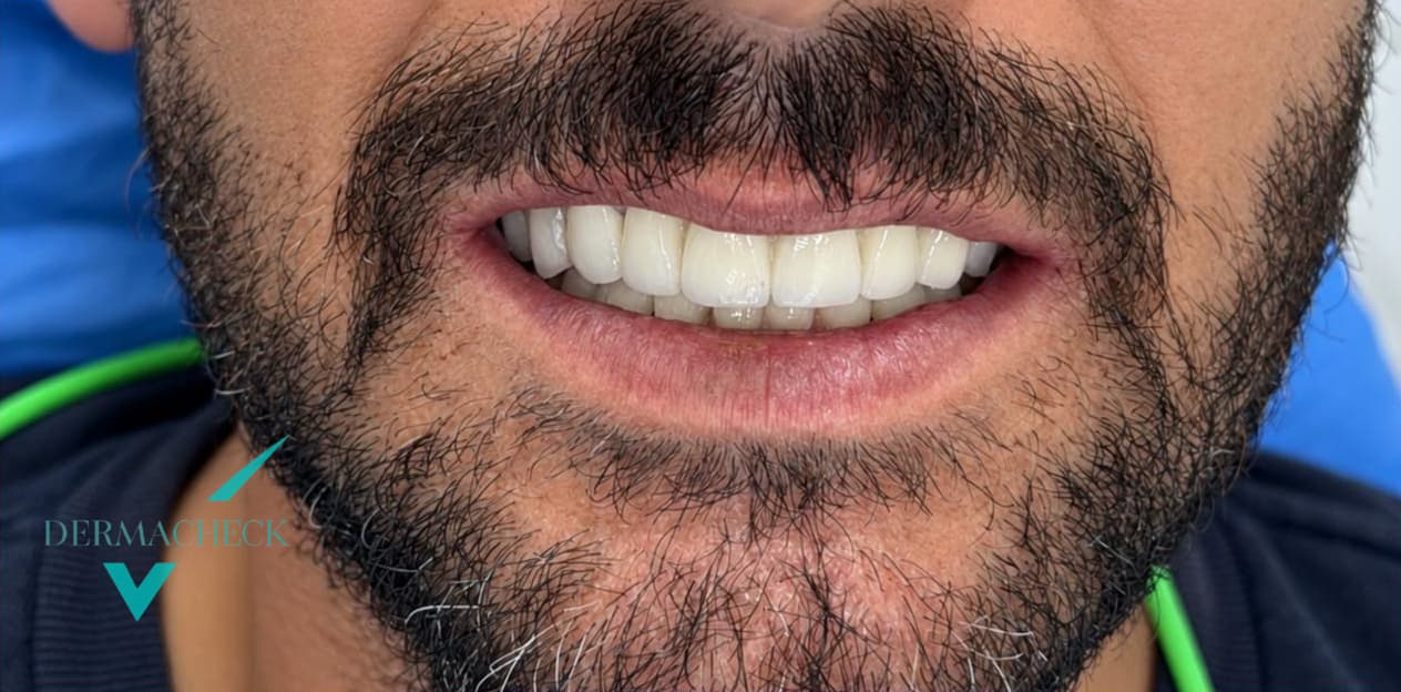 Patient after treatment
