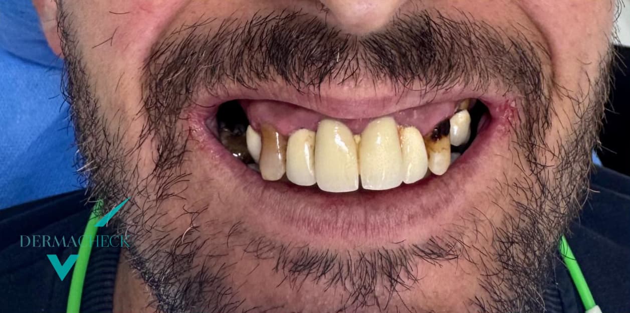 Patient before treatment
