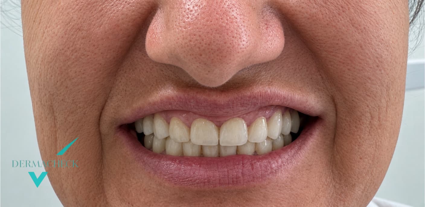 Patient after treatment
