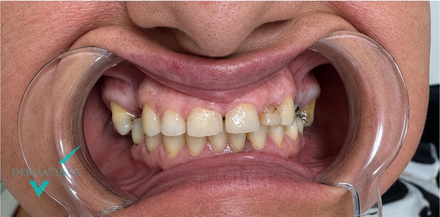 Patient before treatment