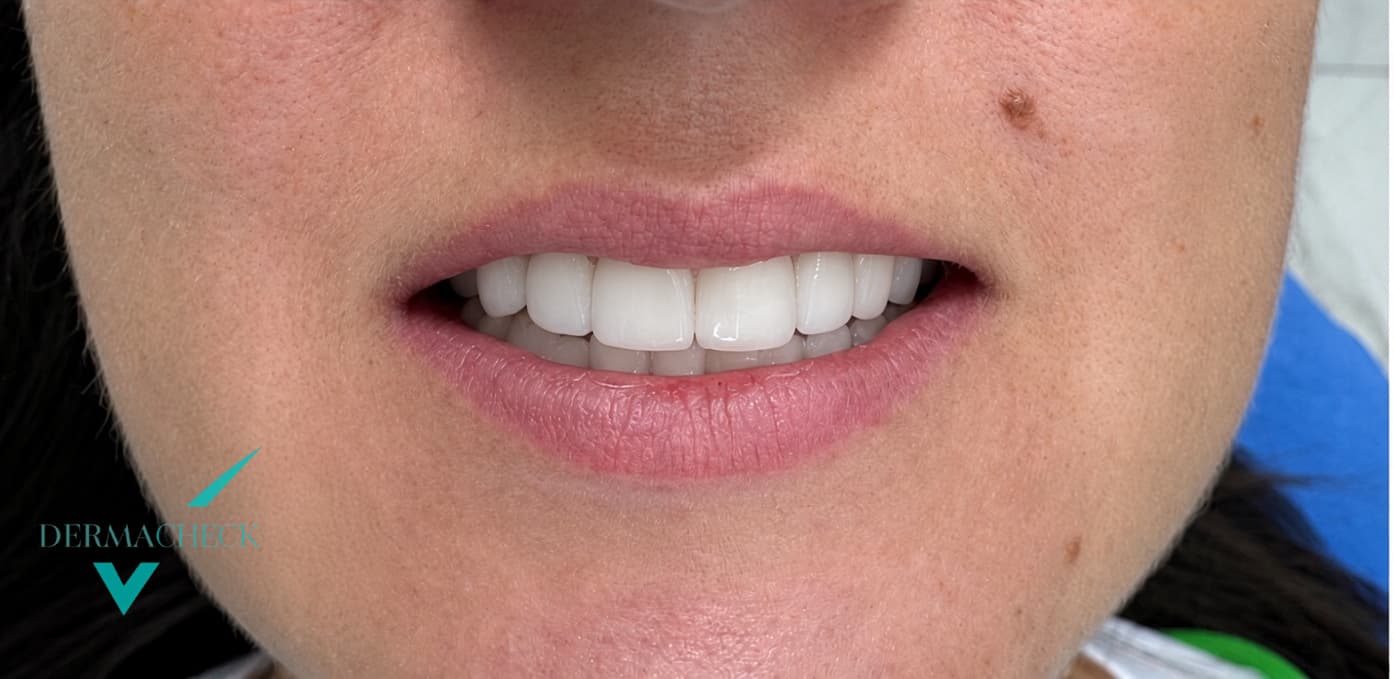 Patient after treatment