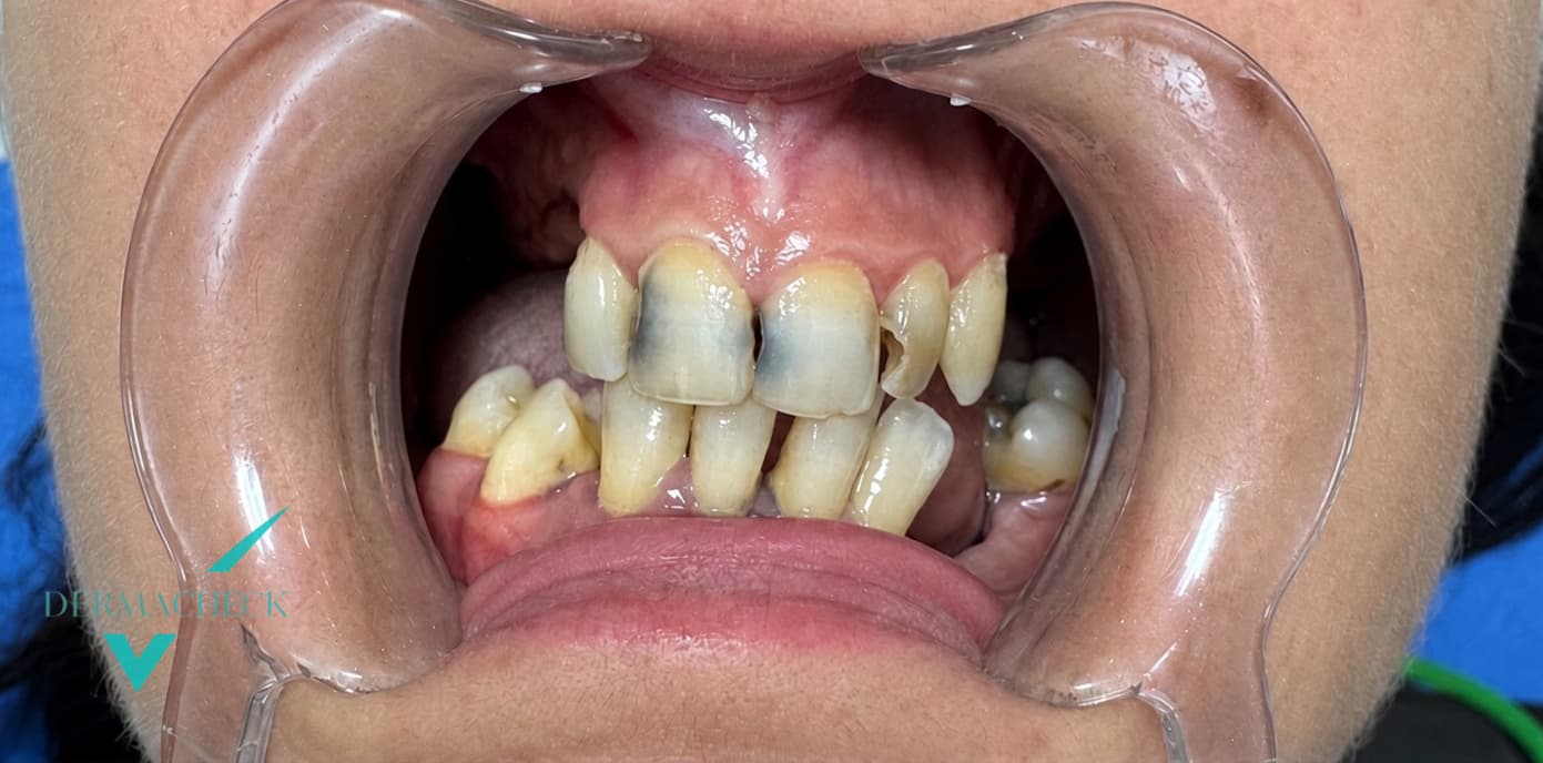 Patient before treatment