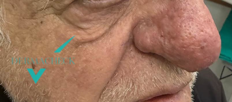 Patient after treatment
