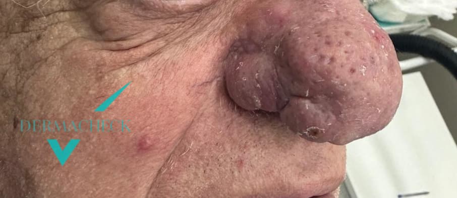 Patient before treatment